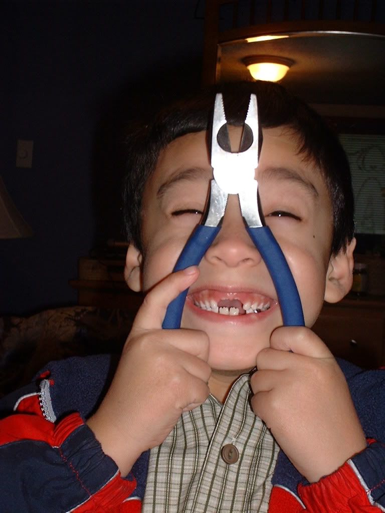 http://i303.photobucket.com/albums/nn125/crlazlo2/for%20first%20cal%20test/twofrontteeth.jpg